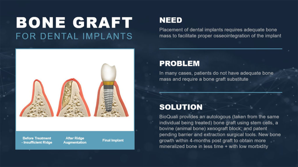 A pitch deck slide titled "Bone Graft for Dental Implants" displays a before-and-after illustration of dental ridge augmentation. It outlines the need for adequate bone mass, the problem of insufficient bone for implants, and Bioquali’s solution using autologous or xenograft bone.